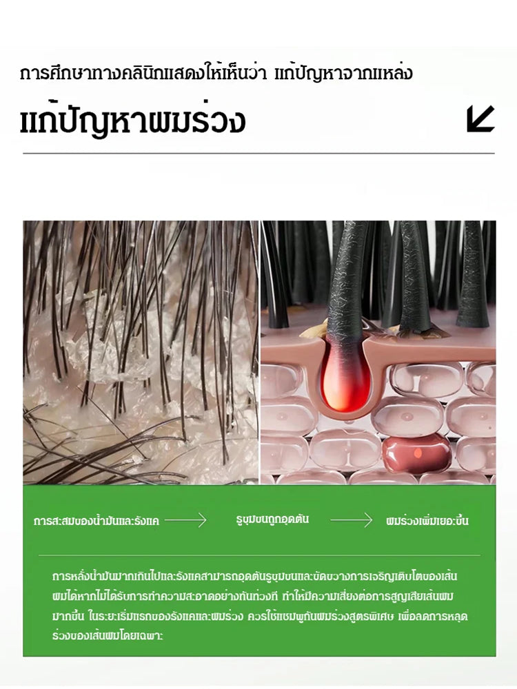 แชมพูลดผมร่วง โรสแมรี่อะมิโน เห็นผลจริง