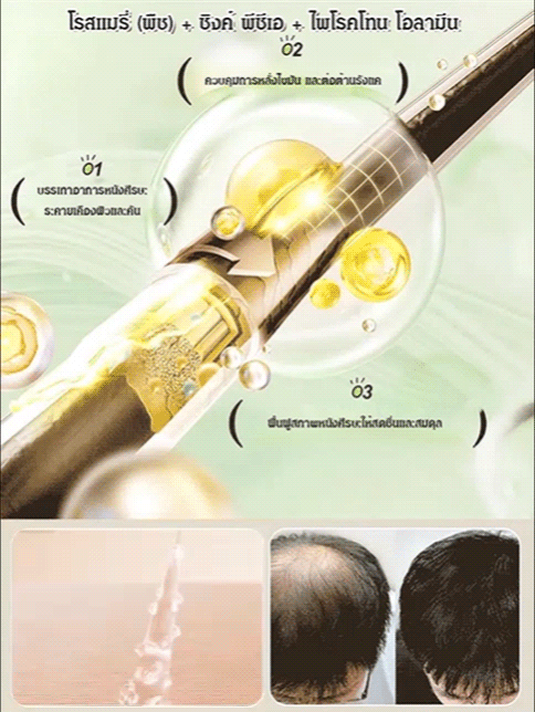 แชมพูลดผมร่วง โรสแมรี่อะมิโน เห็นผลจริง