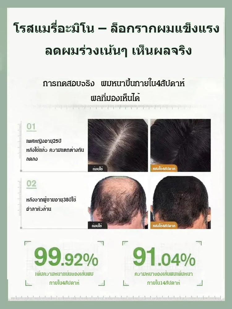 แชมพูลดผมร่วง โรสแมรี่อะมิโน เห็นผลจริง