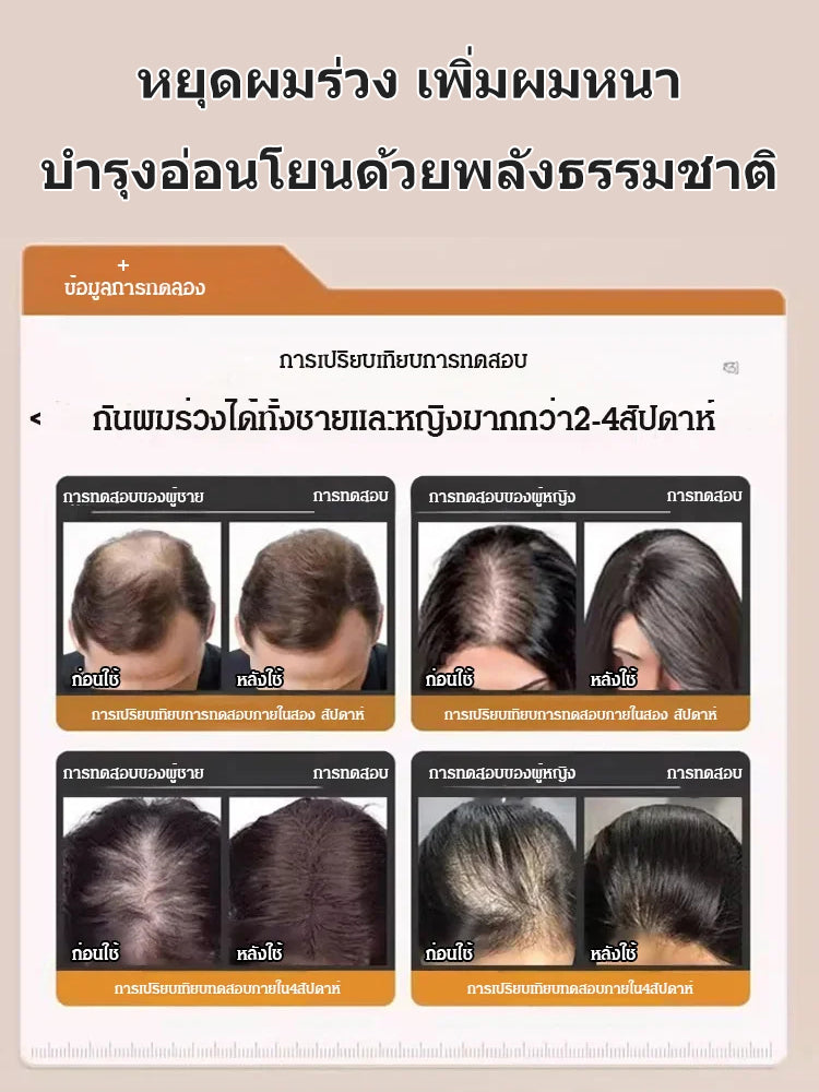 แชมพูลดผมร่วง โรสแมรี่อะมิโน เห็นผลจริง