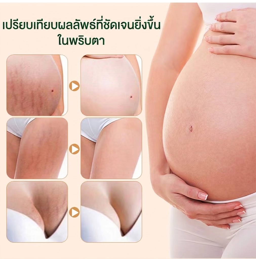 น้ำมันบำรุงผิวจากธรรมชาติที่ช่วยลดรอยแผลเป็นและจุดด่างดำ