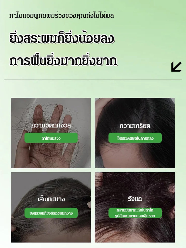 แชมพูลดผมร่วง โรสแมรี่อะมิโน เห็นผลจริง